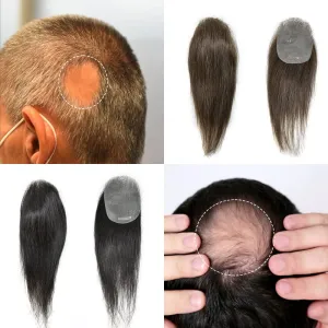 V-Looped Remy Human Hair Patch for Bald Spot - Natural Looking Replacement Unit With Thin Skin for Men (#3 Dark Brown, 4cm X 8cm - 6 Inch)