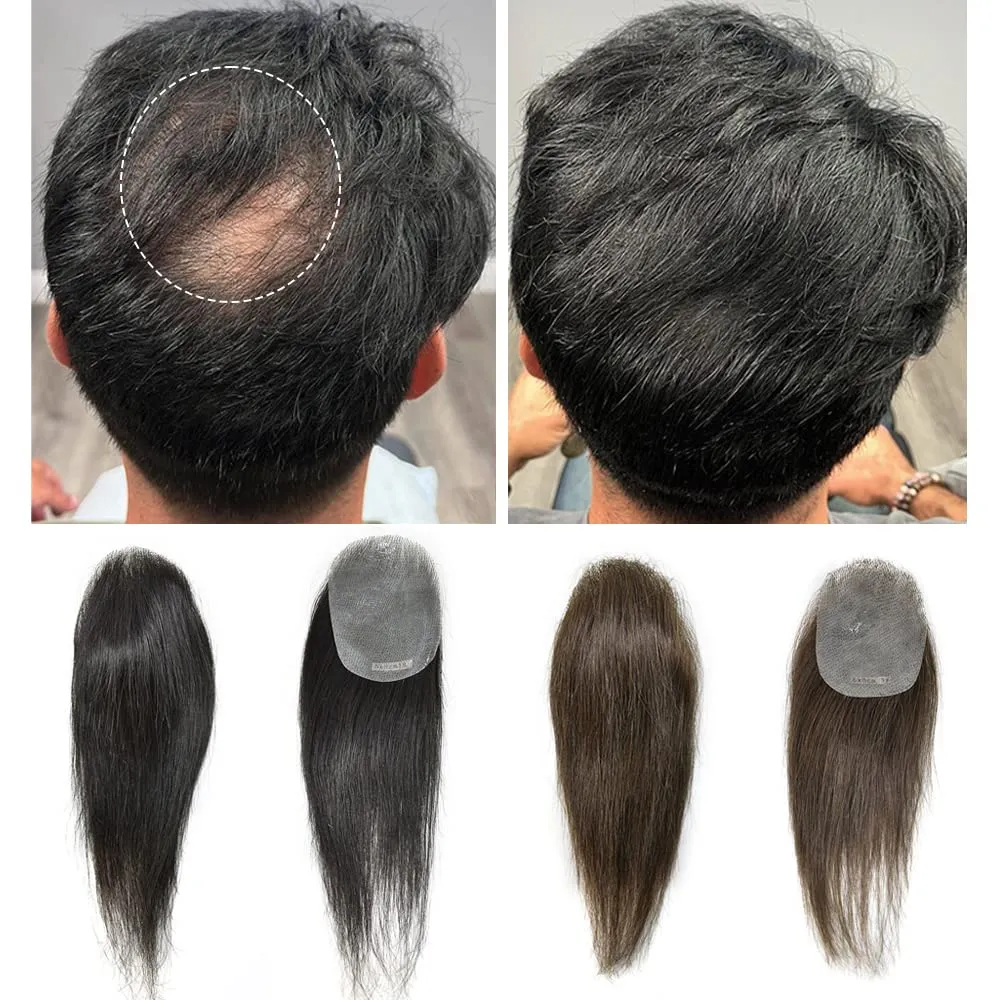 V-Looped Remy Human Hair Patch for Bald Spot - Natural Looking Replacement Unit With Thin Skin for Men (#3 Dark Brown, 4cm X 8cm - 6 Inch)